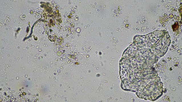 soil microorganisms under the microscope, including, fungi hyphae
