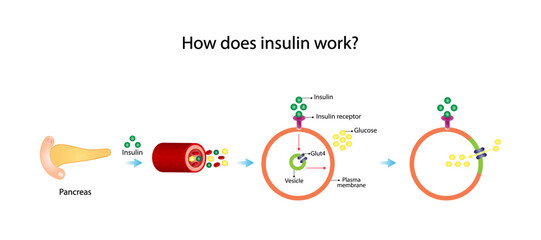 Insulin mechanism of action, regulates glucose metabolism and glucose blood level. Insulin is the key that unlocks glucose channel. Insulin resistance. Vector illustration. - obrazy, fototapety, plakaty