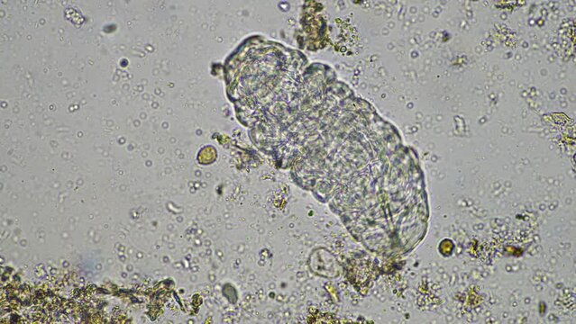 Soil under the microscopy, looking at sand, silt and clay and soil biology, amoebae, fungi, fungal, microbes and nematodes in a cattle farm in australia. 
