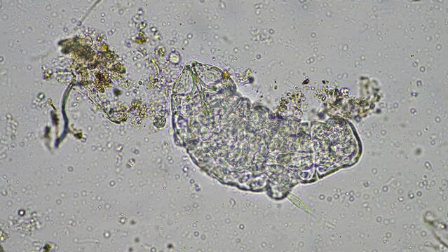 soil microbes, with bacteria, fungi, tardigrade and nematode on a regenerative farm