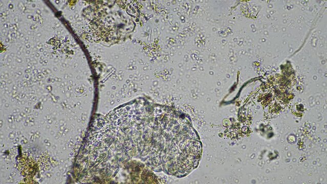 soil microorganisms under the microscope, including, fungi hyphae