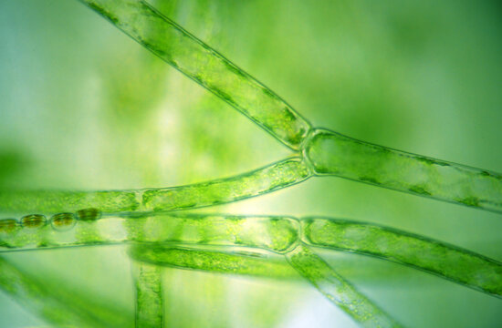 sphagnum moss under a microscope