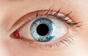  human blue eye is healthy. Eye diseases