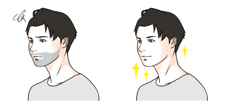 青ひげに悩む男性のビフォーアフターのイラスト	2