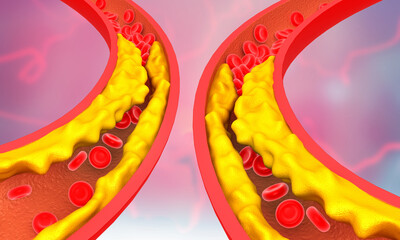 Clogged arteries on scientific background. 3d illustration..