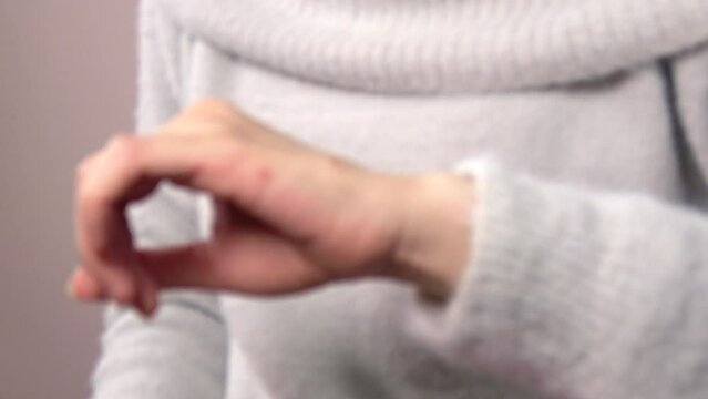 ぼかし背景素材: 手の甲の複数の虫刺されの痕を見せる女性  4K  2023年12月11日