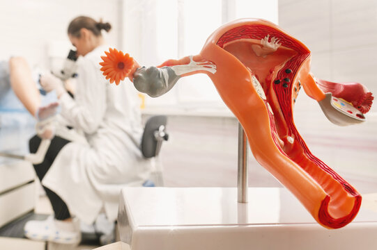 Medical examination in a gynecologist's chair, taking care of women's health. Silicone demonstration model of the female reproductive system (uterus, vagina, ovaries) close-up in the foreground
