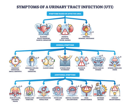 Symptoms of urinary tract infection or UTI bladder disease outline diagram. Labeled educational scheme with affected area, general and additional symptomatic for urology problem vector illustration.