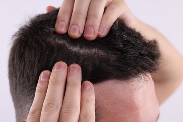 Fototapeta premium Man examining his hair and scalp on white background, closeup