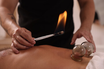 Therapist giving fire cupping treatment to patient indoors, closeup