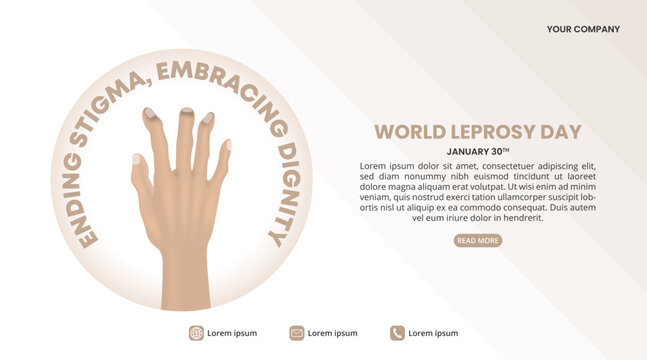 World Leprosy Day background with a claw hand in leprosy