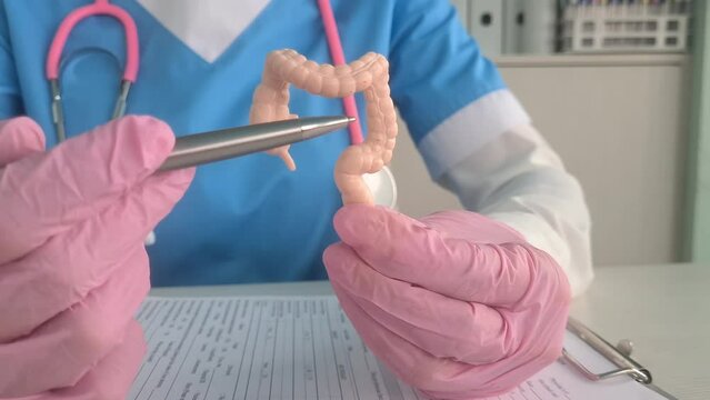 Anatomical model of the intestine with pathology in hands of doctor. Gastroenterologist holding intestinal model