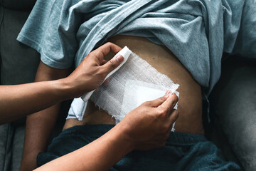 Doctor's hand applying bandage to patient stomach in the clinic, post appendectomy surgery - obrazy, fototapety, plakaty