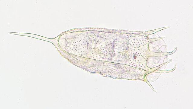 Freshwater rotifer, Keratella sp. Living sample. Stacked image
