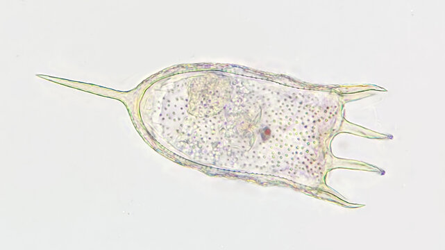 Freshwater rotifer, Keratella sp. Living sample. Stacked image