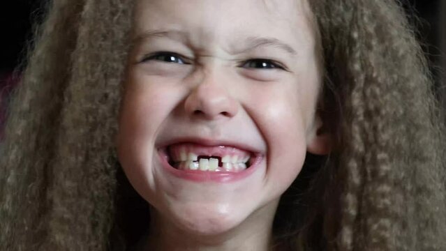 Cute little girl smiles and shows her fallen front milk teeth. Teeth growth. Close-up. Portrait of a 6-year-old rebec