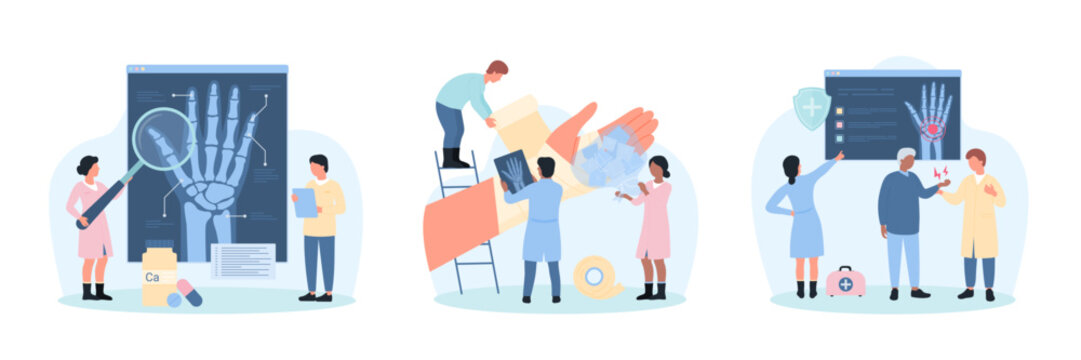 Diagnosis of bone diseases, injury of arm set vector illustration. Cartoon tiny doctors treat broken sick arm with ice and bandage, people examine xray of human wrist with magnifying glass in hospital - Powered by Adobe