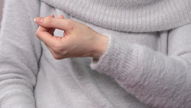 手の甲の複数の虫刺されの痕を見せる女性  4K  2023年12月11日