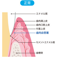 歯の構造　断面図　歯肉
