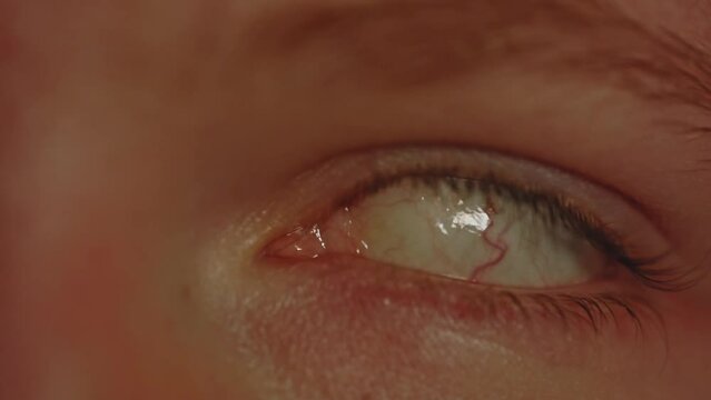 Macro view of eye rolling back in head and turning back