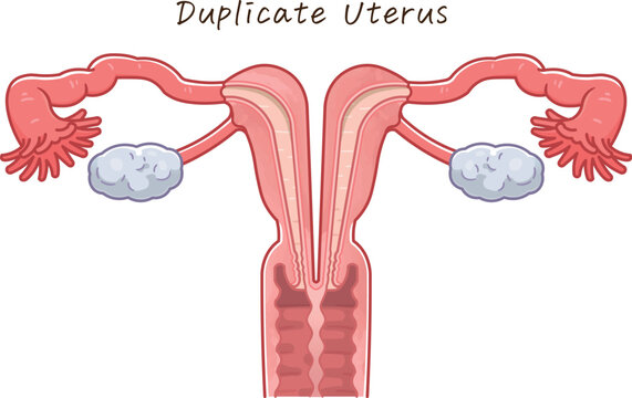 子宮奇形・Uterine malformation