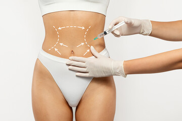 European millennial lady in white underwear receiving cosmetic procedure with marked areas on back