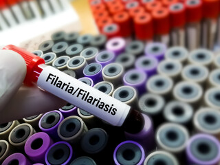 Fototapeta premium Blood sample for Filaria or Filariasis test with medical laboratory background.