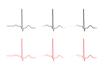 Ventricular repolarization, Cardiac cycle, ECG of heart in normal sinus rhythm, QT interval of ECG. - obrazy, fototapety, plakaty