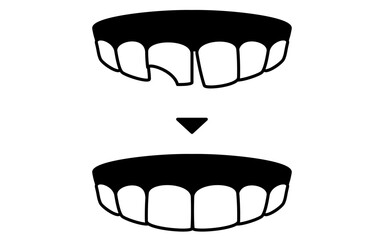 Cosmetic dentistry, direct bonding before and after, simple line drawing