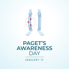 Flyers honoring Paget's Awareness Day or promoting associated events might include vector pictures concerning the day. design of flyers, celebratory materials.