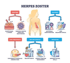 Herpes zoster infection medical symptoms and treatment outline diagram. Labeled educational scheme with skin shingle prevention, diet, lifestyle and long term effects explanation vector illustration. - obrazy, fototapety, plakaty