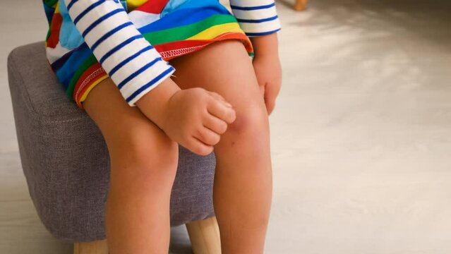 Child has a bruise on his knee. Selective focus.