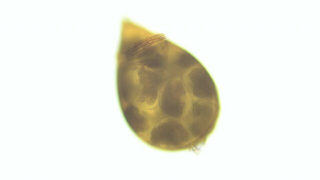 Cocoon with embryos under a microscope, possibly an Oligochaeta or Polycladida worm. Specimen found in White Sea