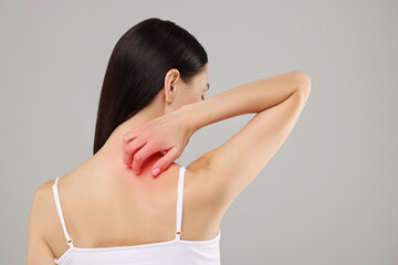 Suffering from allergy. Young woman scratching her skin on light grey background, back view