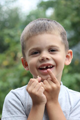 The child lost a tooth. Selective focus.Concept baby tooth