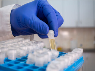 A yellow substance in a test tube, a scientist takes out one test tube from a set of test tubes in...