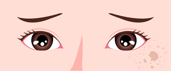 Vector illustration of normal facial skin and facial skin with spots. - obrazy, fototapety, plakaty