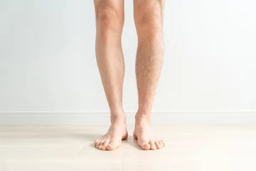 Foto op Plexiglas 男性のムダ毛・脱毛・剃毛のイメージ（脱毛した脚としていない脚）  © buritora