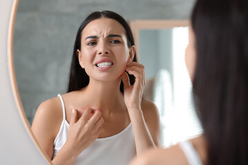 Suffering from allergy. Young woman scratching her neck near mirror indoors