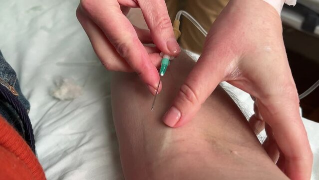 Nurse puts an IV on a man. POV of a man's arm with an IV needle in the median cubital vein (antecubital vein). A person is receiving intravenous fluid. Intravenous injections, medical care in a clinic