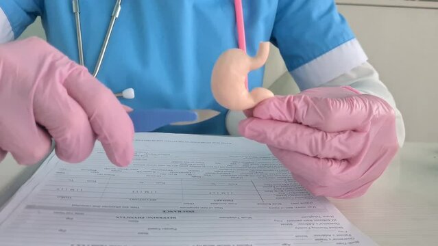 Surgeon held scalpel over an anatomical model of human stomach. Photosurgical treatment of stomach diseases and procedures