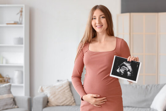 Young pregnant woman with sonogram image at home