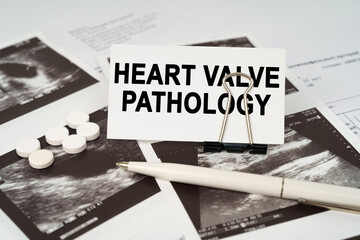 On the ultrasound pictures there is a pen and a business card with the inscription - heart valve...