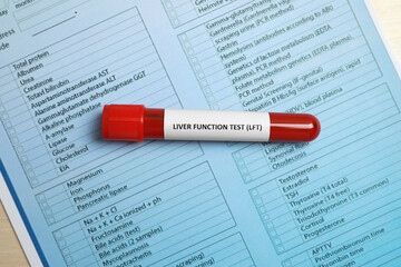 Liver Function Test. Tube with blood sample and laboratory form on table, top view