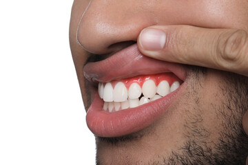 Man showing inflamed gum on white background, closeup