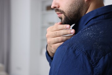 Man brushing dandruff off his shirt indoors, closeup. Space for text - obrazy, fototapety, plakaty
