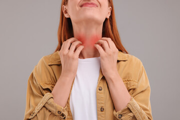 Suffering from allergy. Young woman scratching her neck on grey background, closeup
