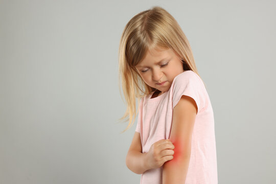 Suffering from allergy. Little girl scratching her arm on light gray background, space for text