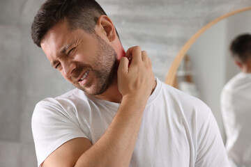 Man suffering from allergy scratching his neck indoors