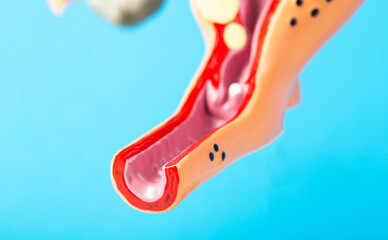 Mockup of the female reproductive system of the vagina on a blue background. Concept of diseases...